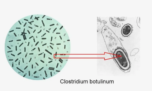 Клостридия.