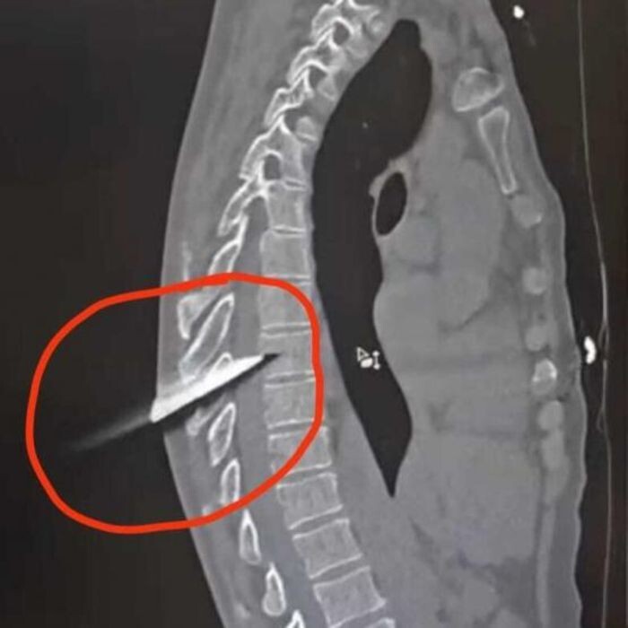 Источник фото: Минздрав РО