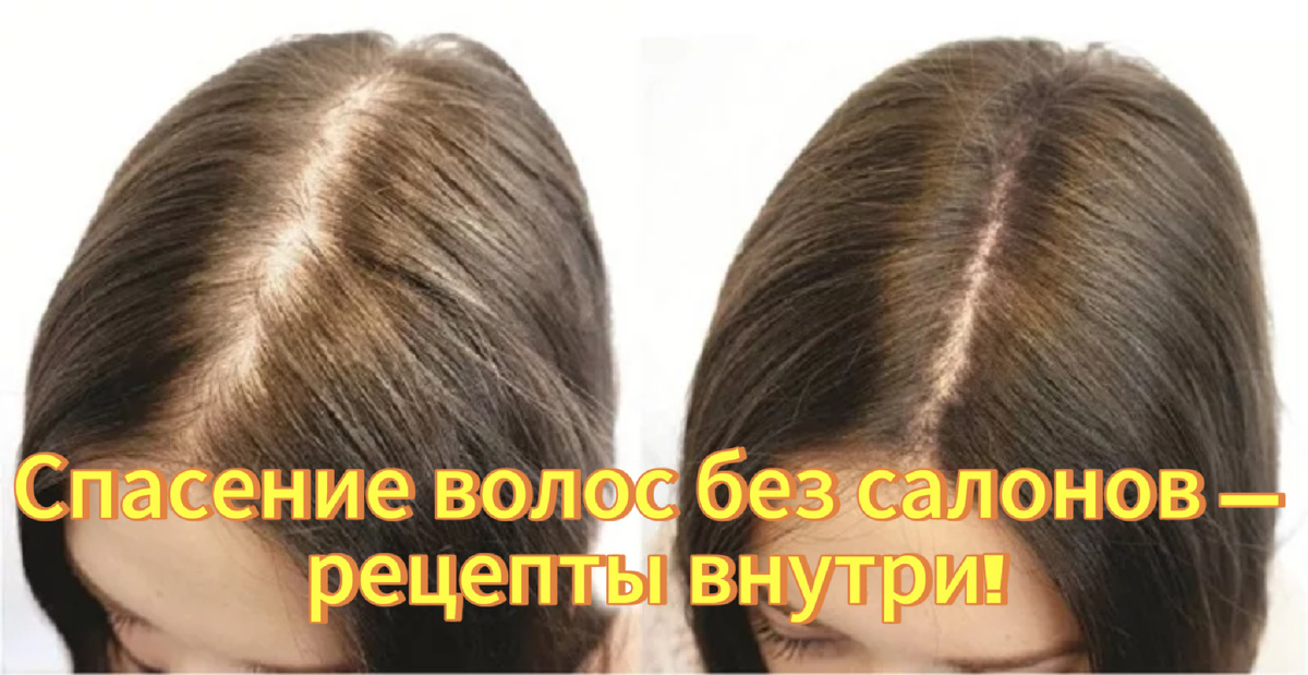 Спасение волос без салонов — рецепты внутри!