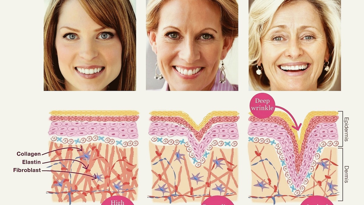 Уменьшение коллагена в организме от 35 до 65 (фото из открытых источников)