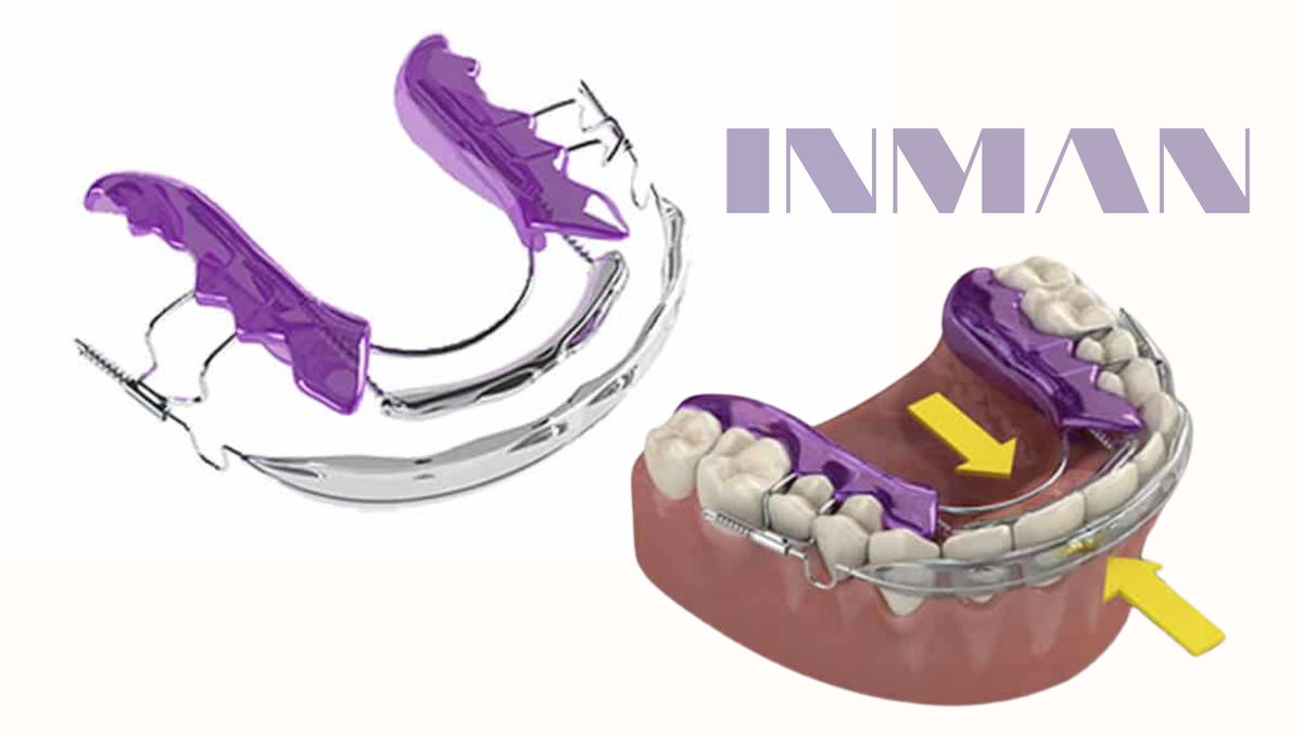 Inman элайнеры