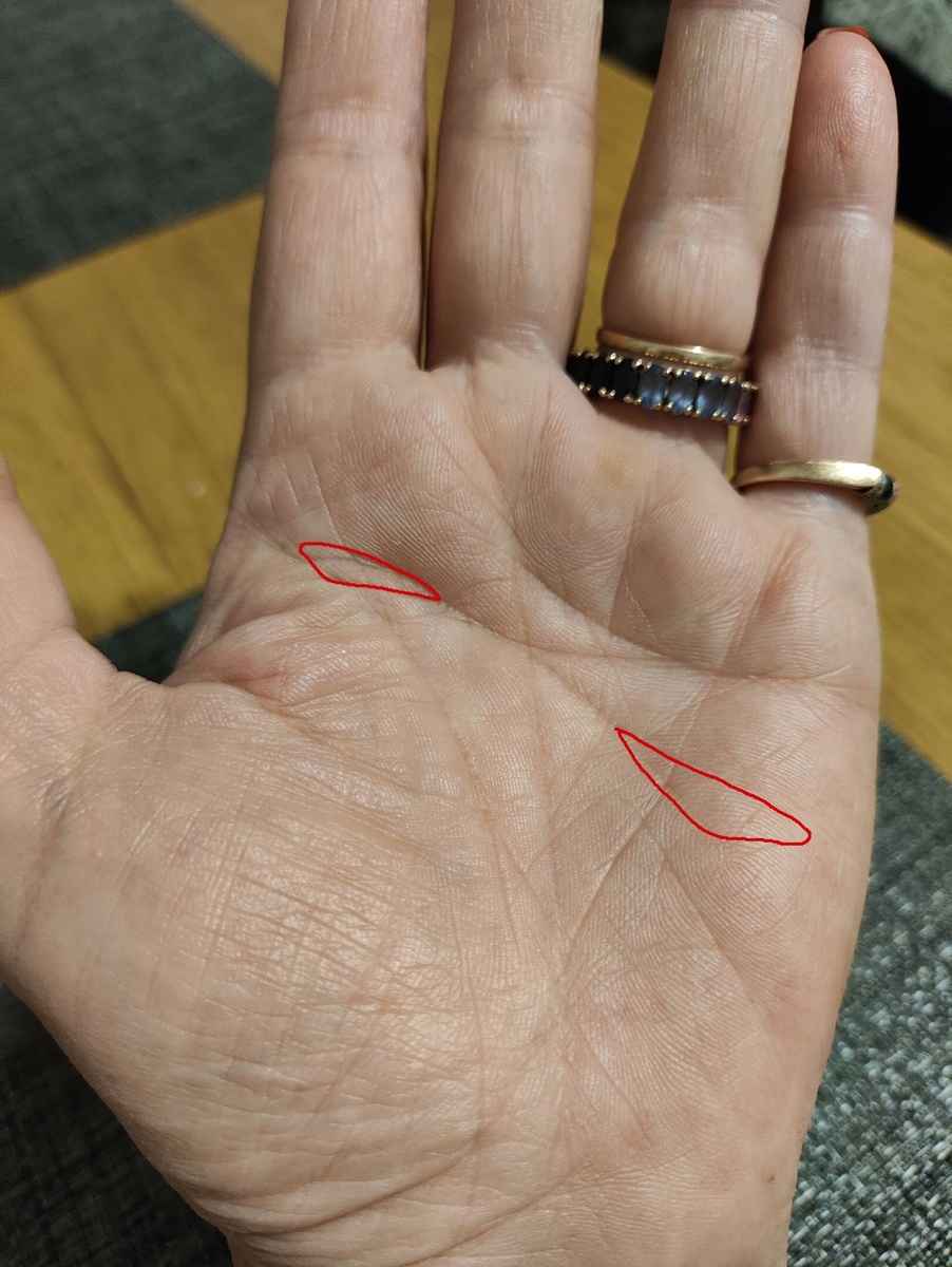 Та самая картинка. "Глаза ведьмы" в двух местах. На конце линии головы и в начале