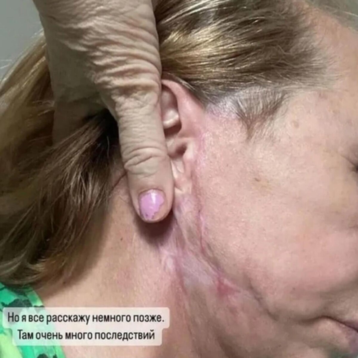    Мать Виктории Бони после операции. соцсети