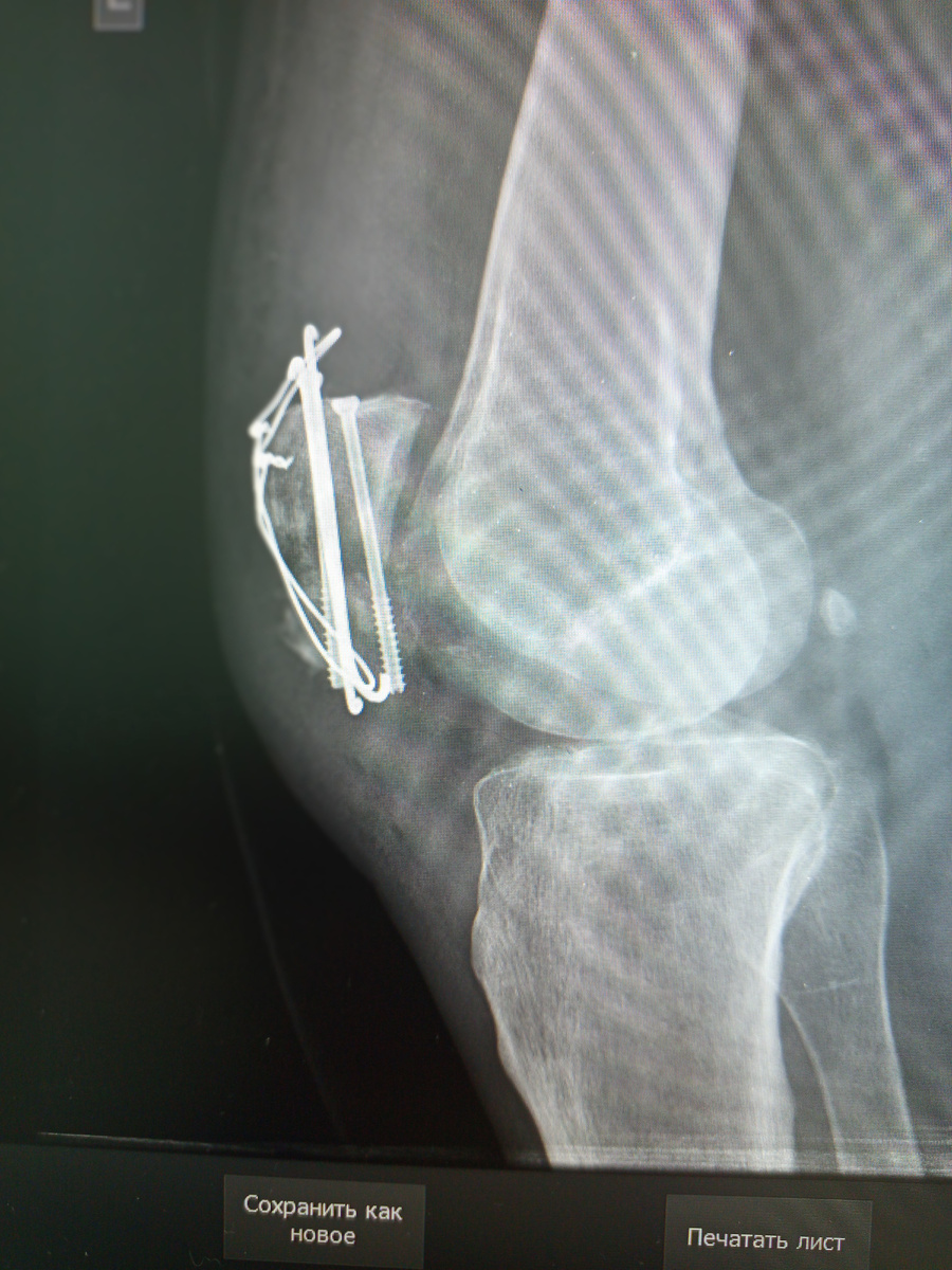 МОС по Веберу