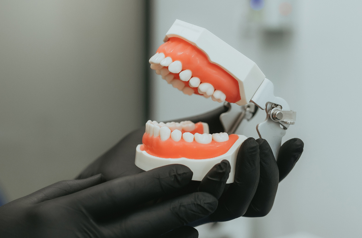 Как правило, кариес возникает у большинства пациентов со скученностью зубов.