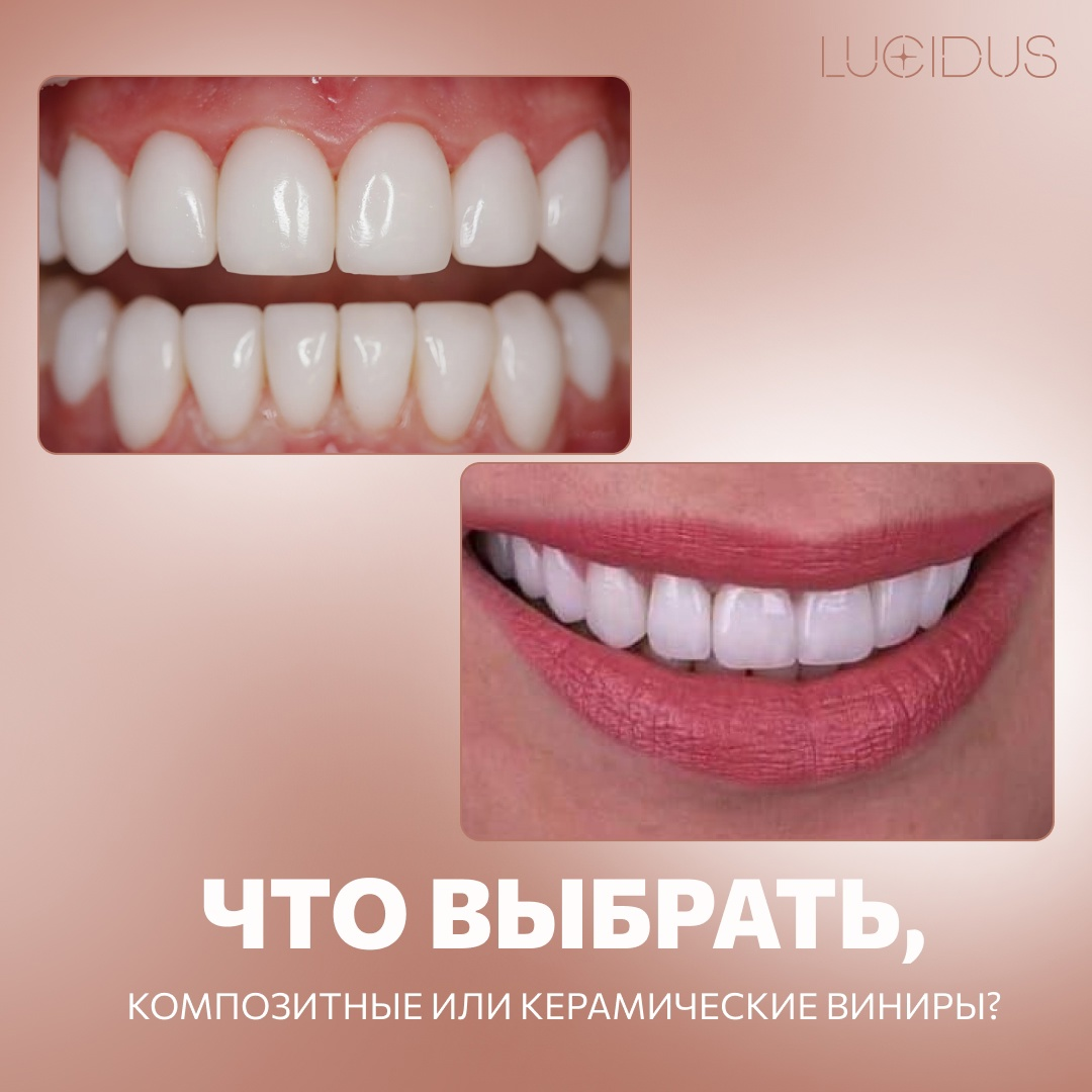 Керамика выглядит более естественно