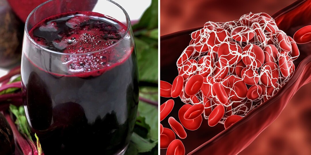 В СССР жили до 100 и не знали, что такое тромбы: 3 продукта, которые разжижают кровь лучше лекарств