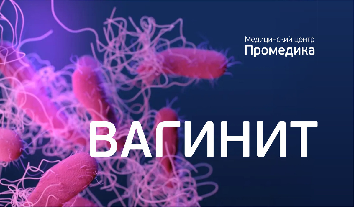 Вагинит: как понять, что он есть, каким бывает и как лечить?