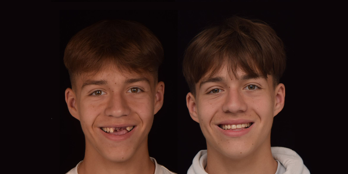 Фотография предоставлена Центром дентальной травматологии New Iceberg