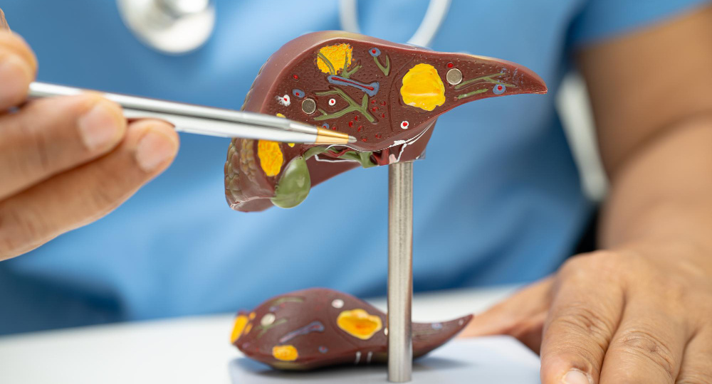 Жировая болезнь печени из-за алкоголя: как её избежать