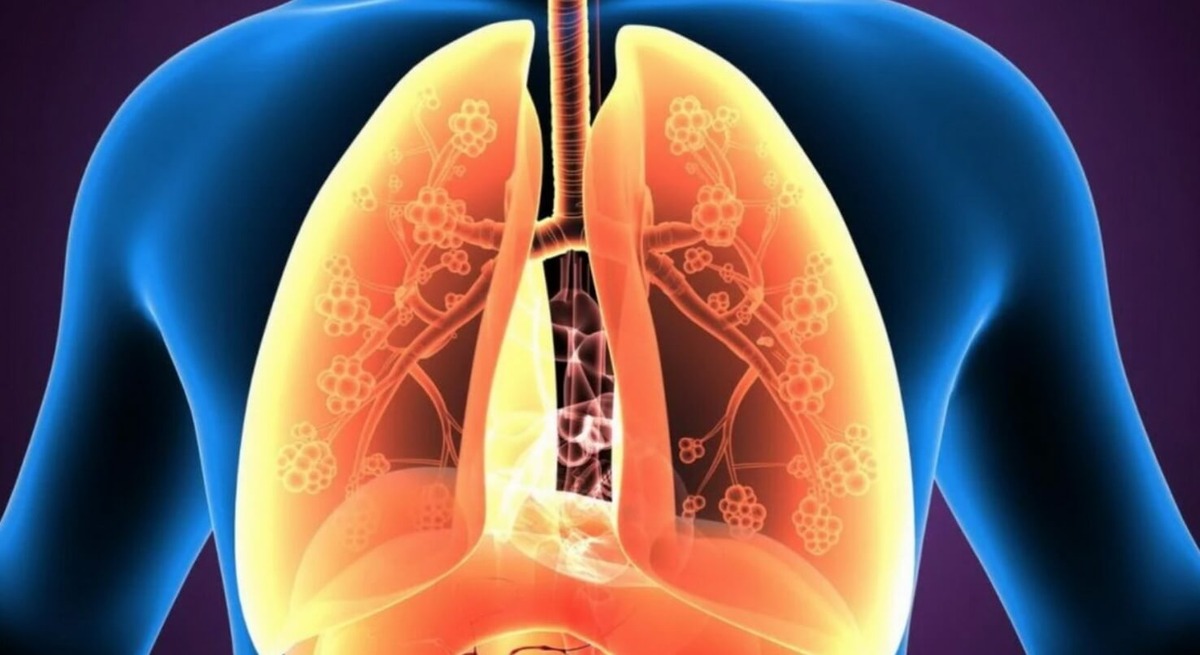    Приступ астмы начинается не на ровном месте — всегда есть провоцирующий фактор. Источник изображения: 1rkb.ru