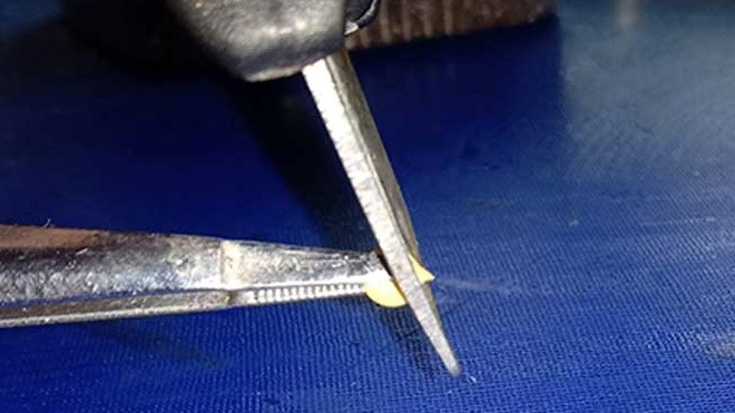 Техника "хирургического" метода требует аккуратности — срезаем не более 1 мм с носика семени.