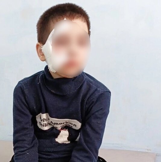 Собака прокусила лицо мальчику до крови. Фото: Скриншот vk.com