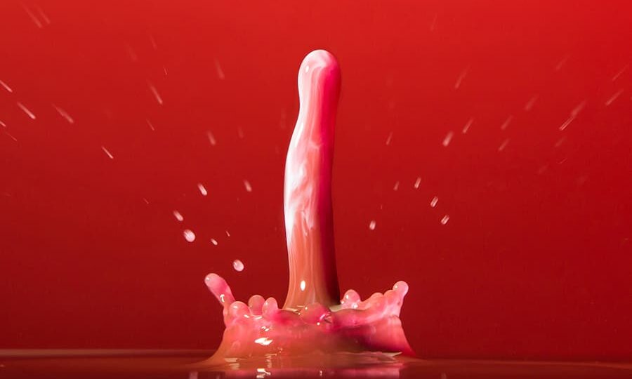 Как понять, что у вас геморрой?