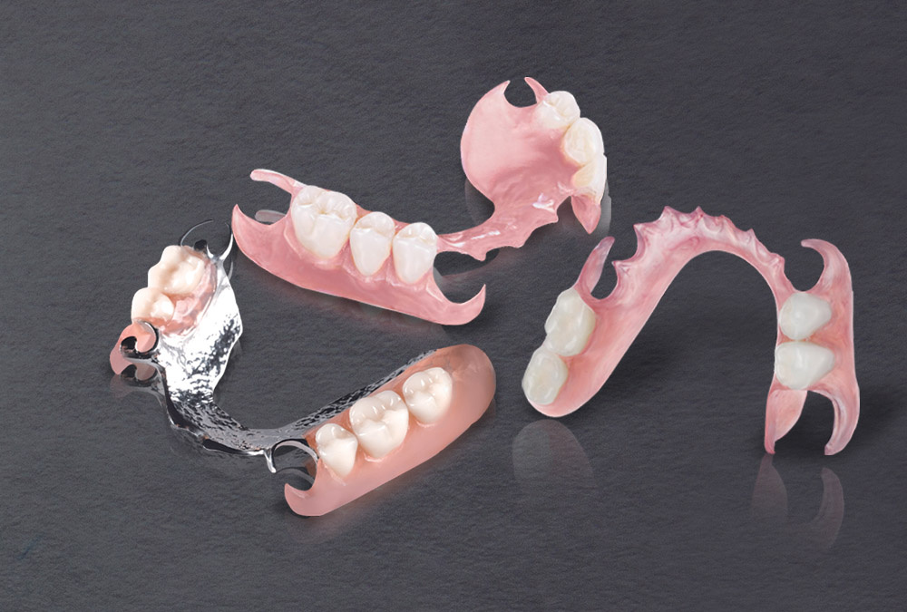 Все существующие варианты зубных протезов