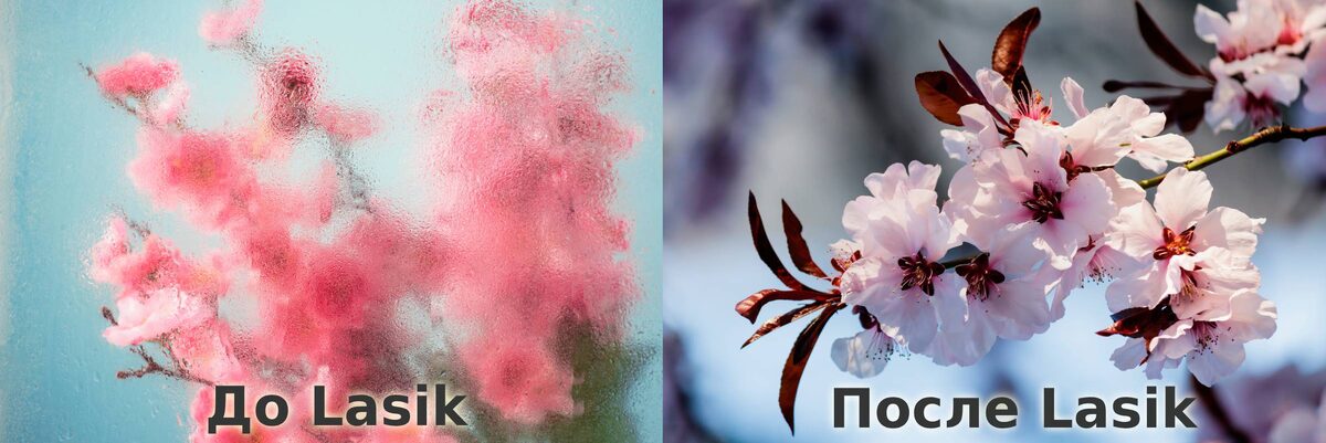 Фото с сайта Freepik.com. Вот так, примерно, разделился мой мир после лазерной коррекции