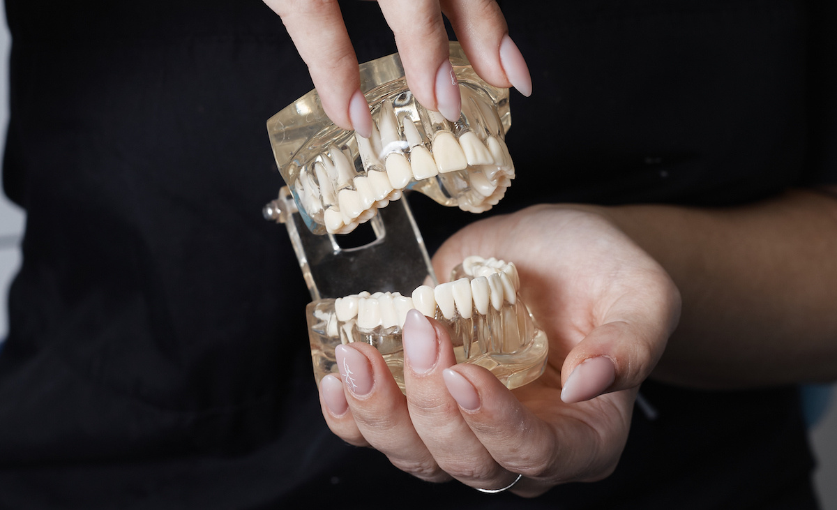 Съёмный протез на верхнюю челюсть в Дентру. Первоуральск