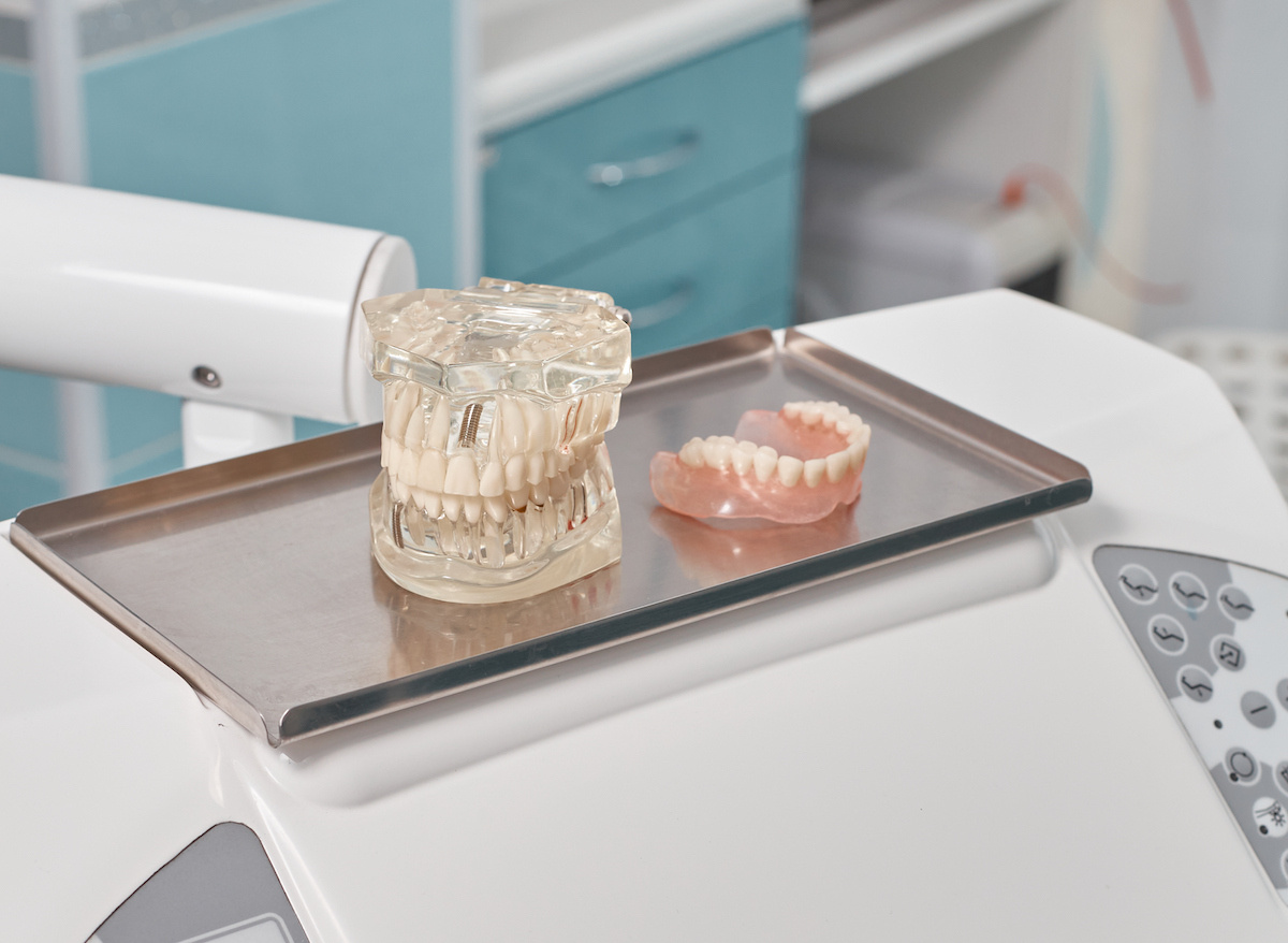 Шаблонная имплантация в Первоуральске