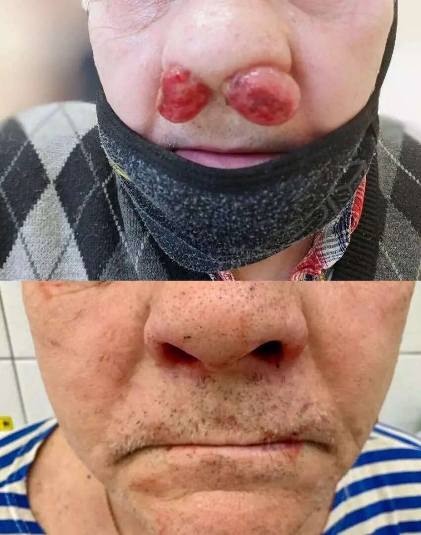     Источник: Пресс-служба минздрава Удмуртии