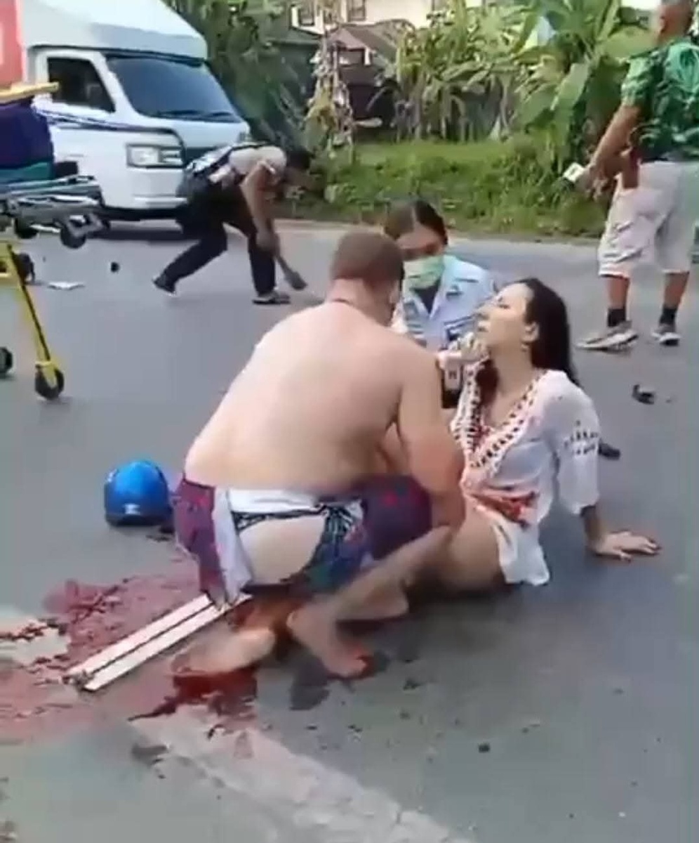 Массивная кровопотеря, болевой шок... 