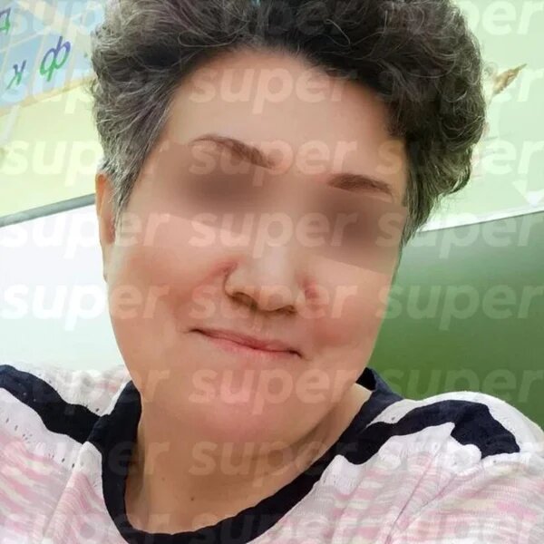    Буйнов сбил Аллу Николаевну, фото: телеграм