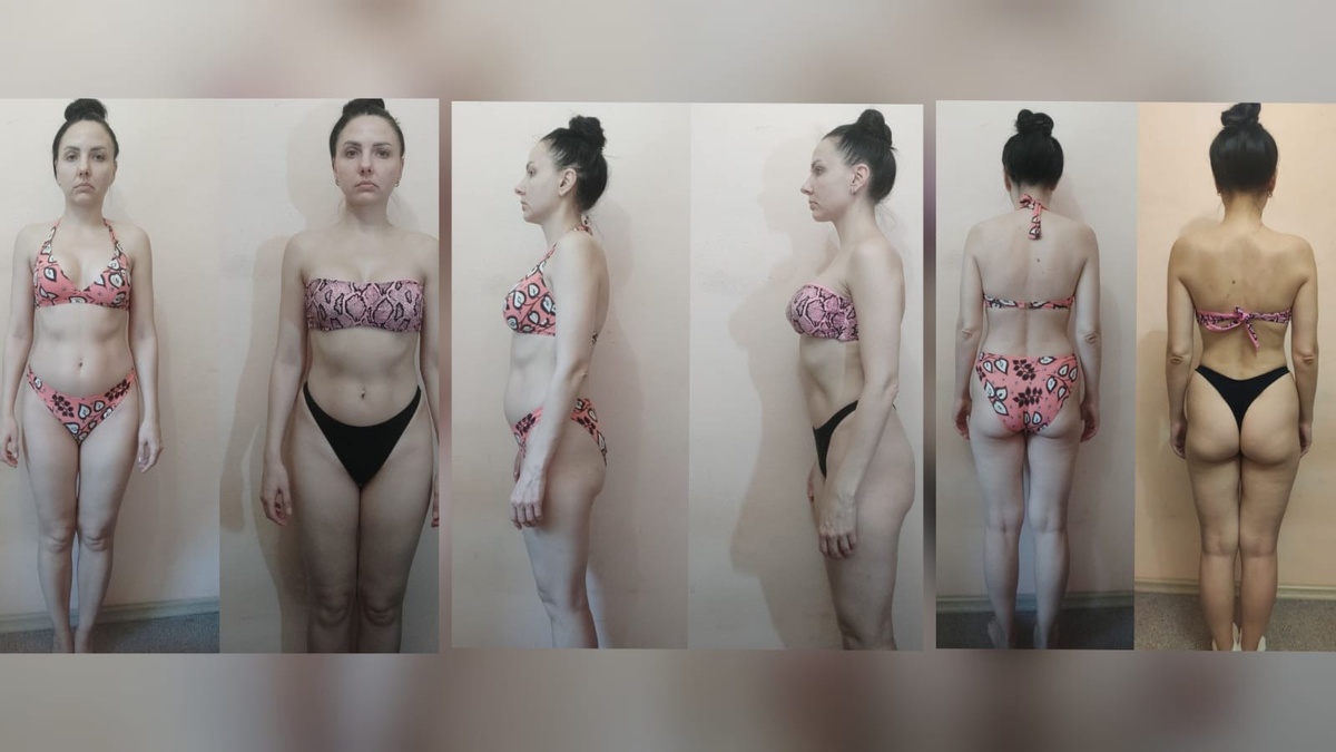 Участница программы "DIVAПреображение". До программы сутулость - после сутулость ушла