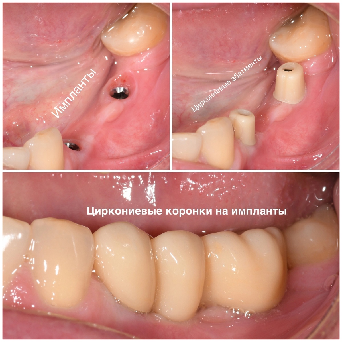 Тут на примере моей работы подписал что есть что