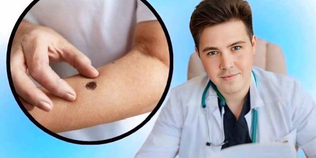 Меланома и базалиома : как не пропустить тревожные симптомы рака кожи