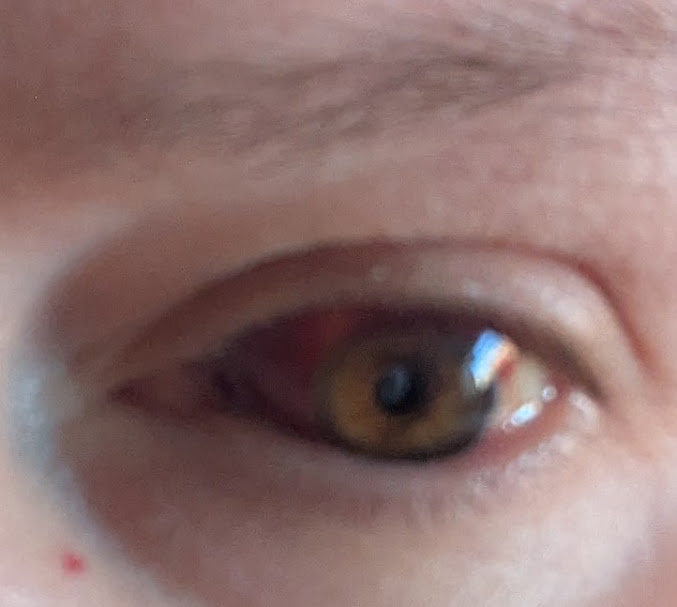 Мой (пре)красный глаз