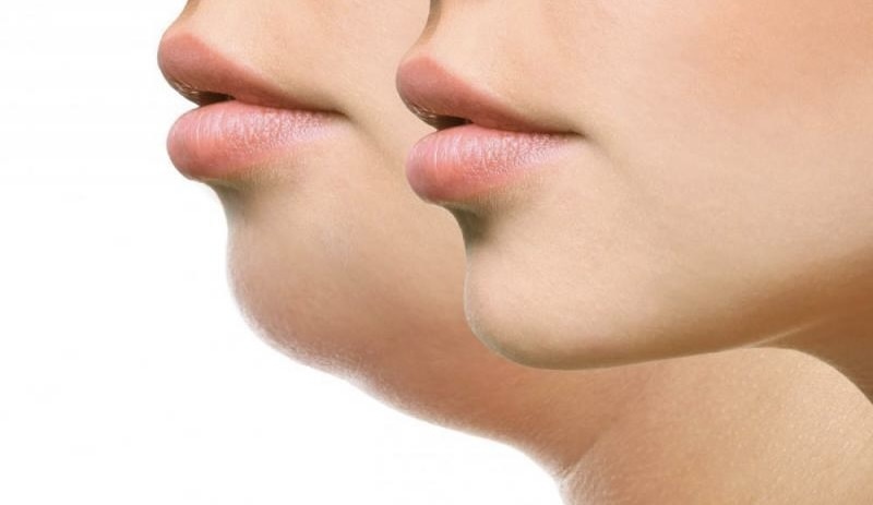 Источник: turquiesante.com