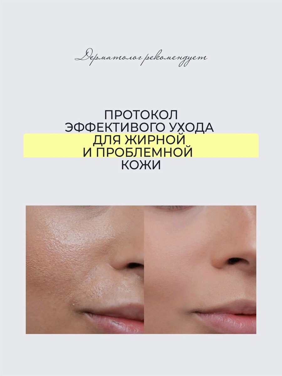 -1-2
