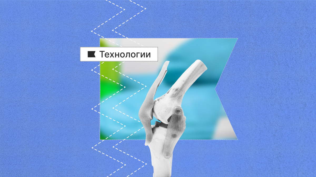 Учёные взяли несколько существующих на рынке биосовместимых полимеров-термопластов и изучили их поведение при различных внешних воздействиях.