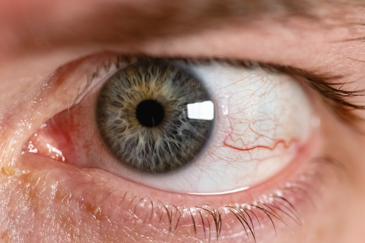    «Мы видим мир вполне объективным. Электромагнитная волна отражается от предметов и попадает нам в глаз, где эта длина преломляется при помощи оптических сред — роговицы, хрусталика и фокусируется в так называемой макуле».   
Фото: «БИЗНЕС Online»