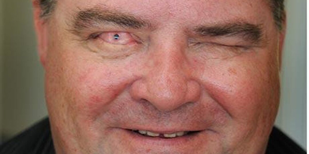 Вживили зуб в глаз. Для чего и в каких случаях делают такие операции