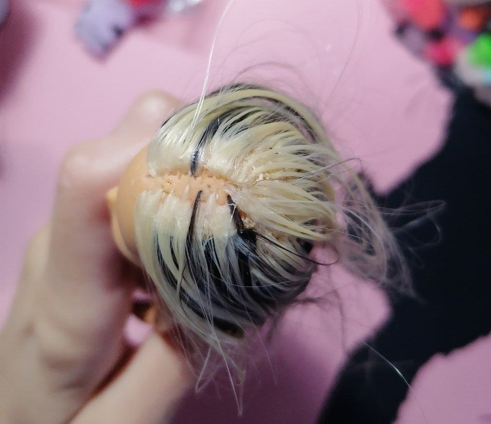 Лысина в зоне пробора