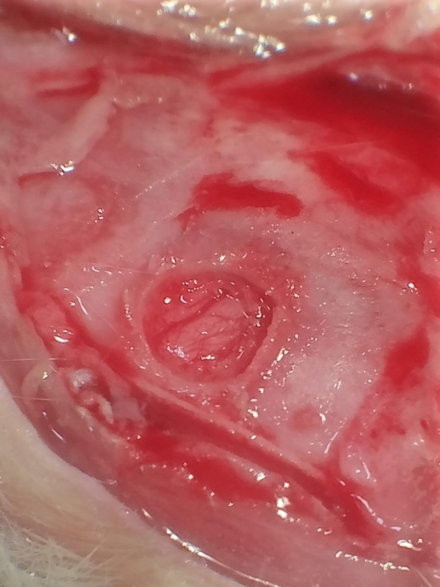 Область после операции