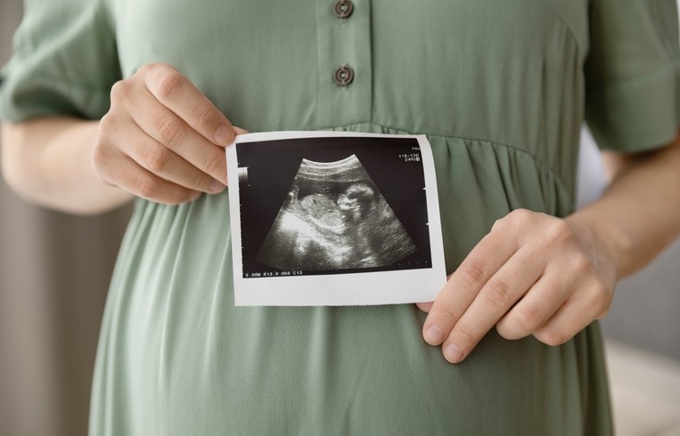    Shutterstock/FOTODOM