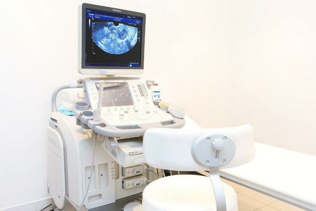 Аппарат УЗИ