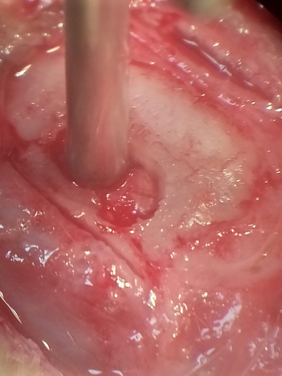 Электрод уже на считывание кровотока