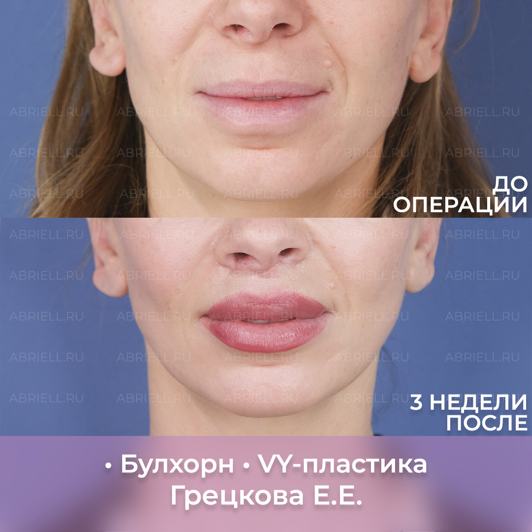 Хирург: Грецкова Е.Е. 