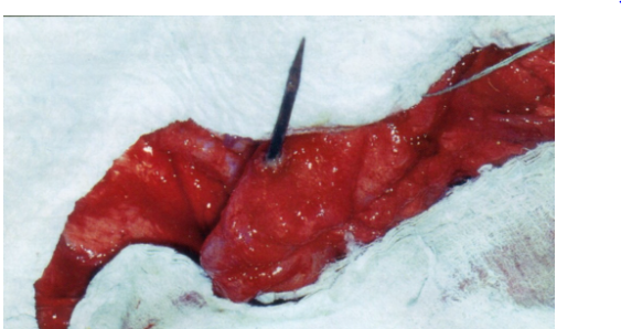 Перфорация брюшной полости инородным предметом часто является причиной перитонита. На снимке: перфорация тонкой кишки собаки деревянным вертелом