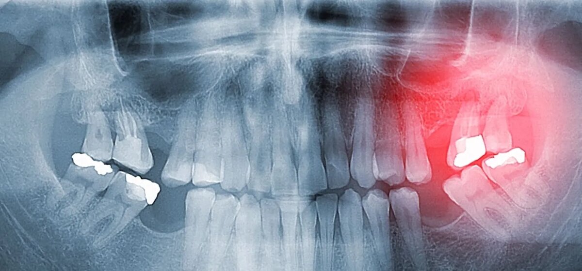 Фото взято из открытых источников 