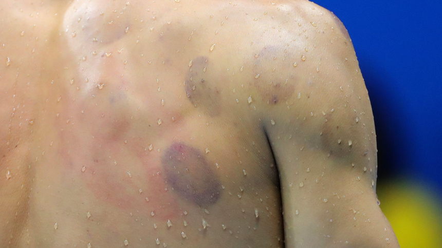    Фото: www.globallookpress.com/Michael Kappeler