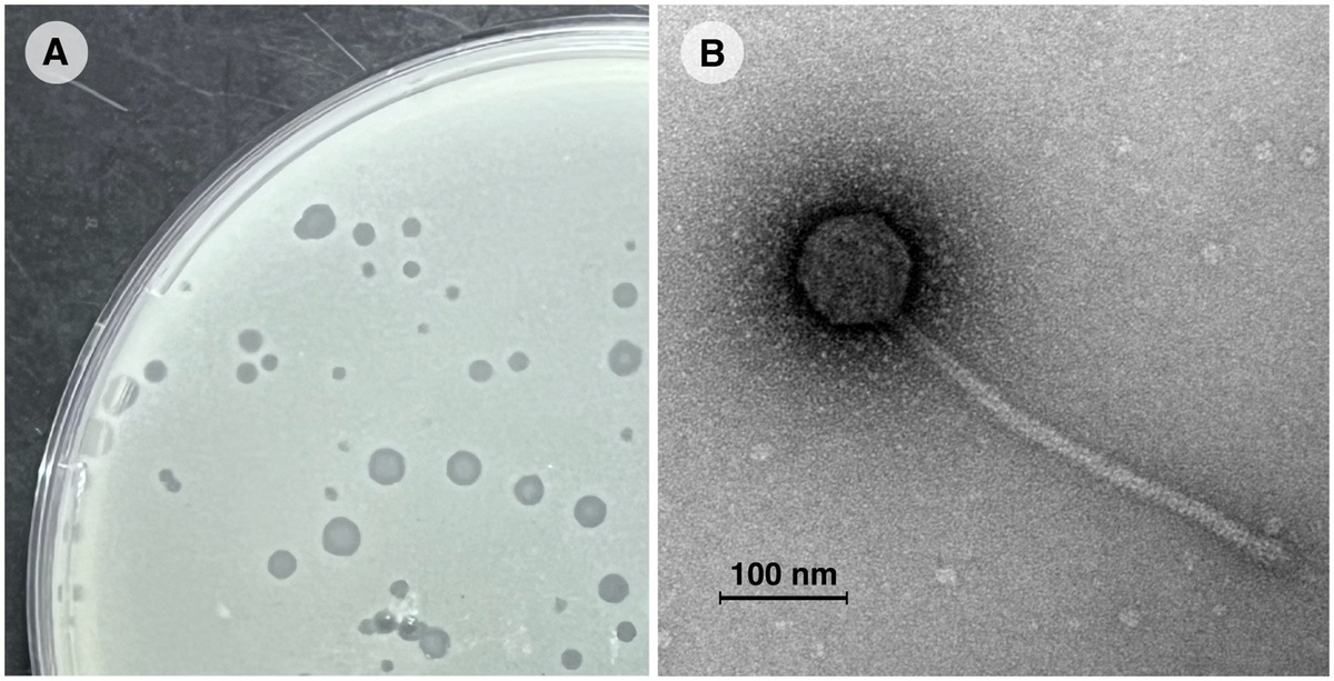 А — лабораторная культура бактерии Mycobacterium smegmatis, пораженная микобактериофагом Vic9. B — электронная микрофотография микобактериофага Vic9. Источник: Marina Zaychikova/ Frontiers in Microbiology, 2025