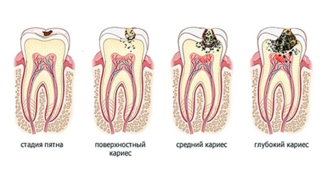 Психосоматика зубов