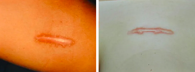 Фото: ncbi.nlm.nih.gov