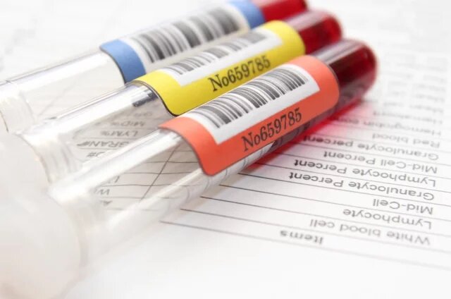    Что делать, если повышены эозинофилы?