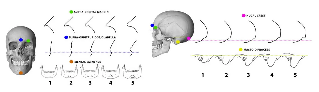 Система оценок для различных частей черепа. ближе к 1 — более женский, ближе к 5 — более мужской.