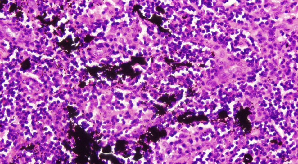   CM Jack et al. / International Seminars in Surgical Oncology, 2005