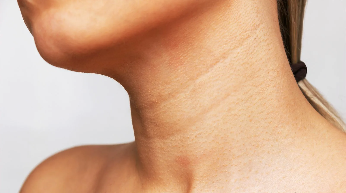 Как выглядят кольца Венеры